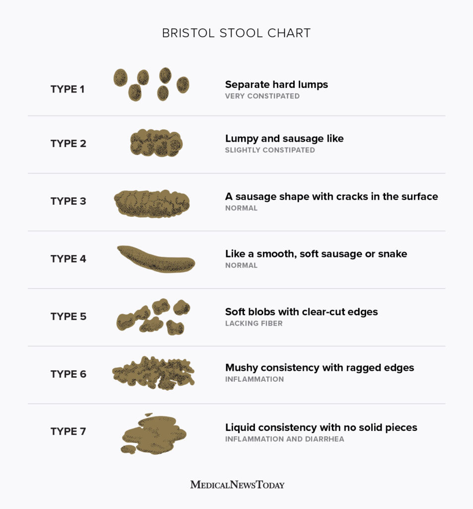 15970 bristol stool chart 1296x1394 english body 952x1024