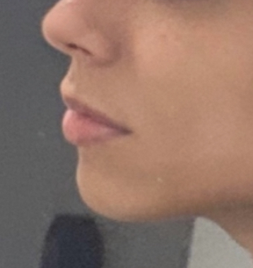 4A8B4E2C 864C 4F13 B430 B4E2DA14E9BA 1 201 a