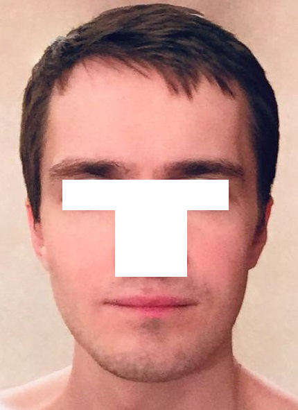 X1 X1