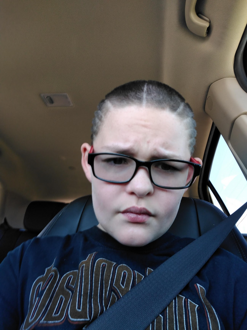 JamesSapphirePreSurgery3.png
