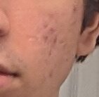 PXL_20230328_083815829 (3).jpg