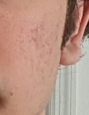 PXL_20230330_195129086 (2).jpg