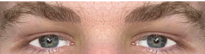 RATE EYE AREA.png