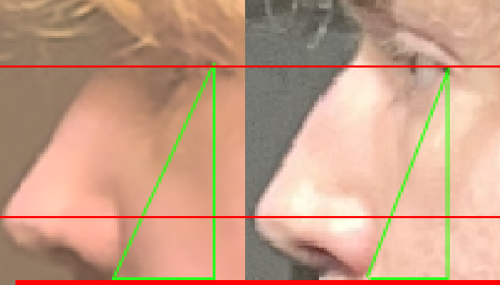 midface.png
