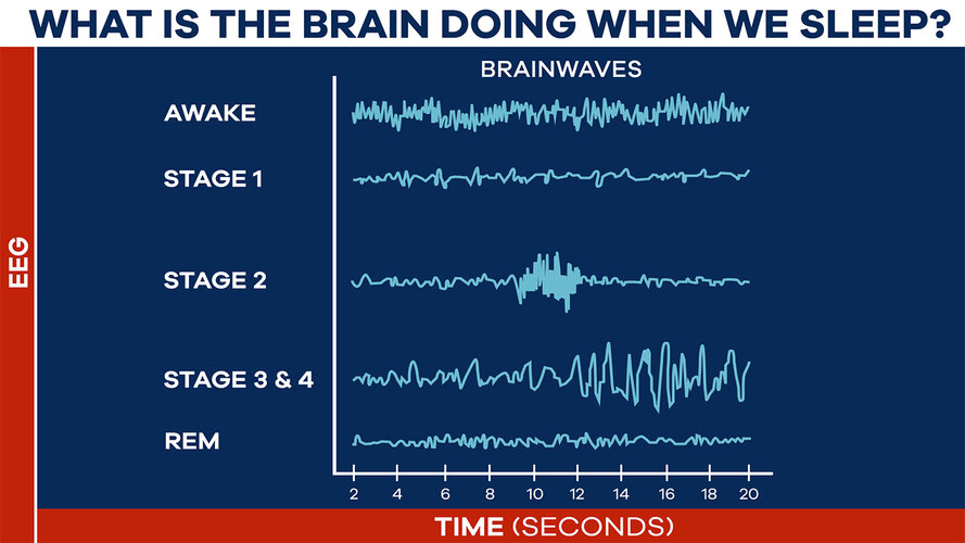 rem_sleep_line_chart1280x720jpg.jpeg