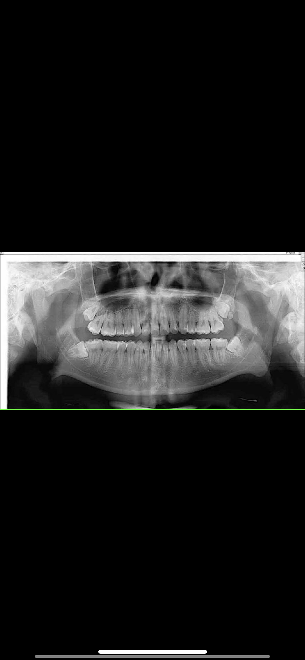 1BAB2605 5245 4A77 BDFD 5F90CF5D384B