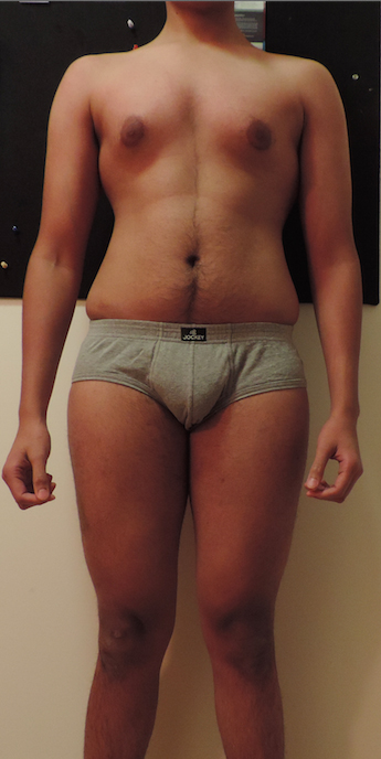 Skinny fat to summer body