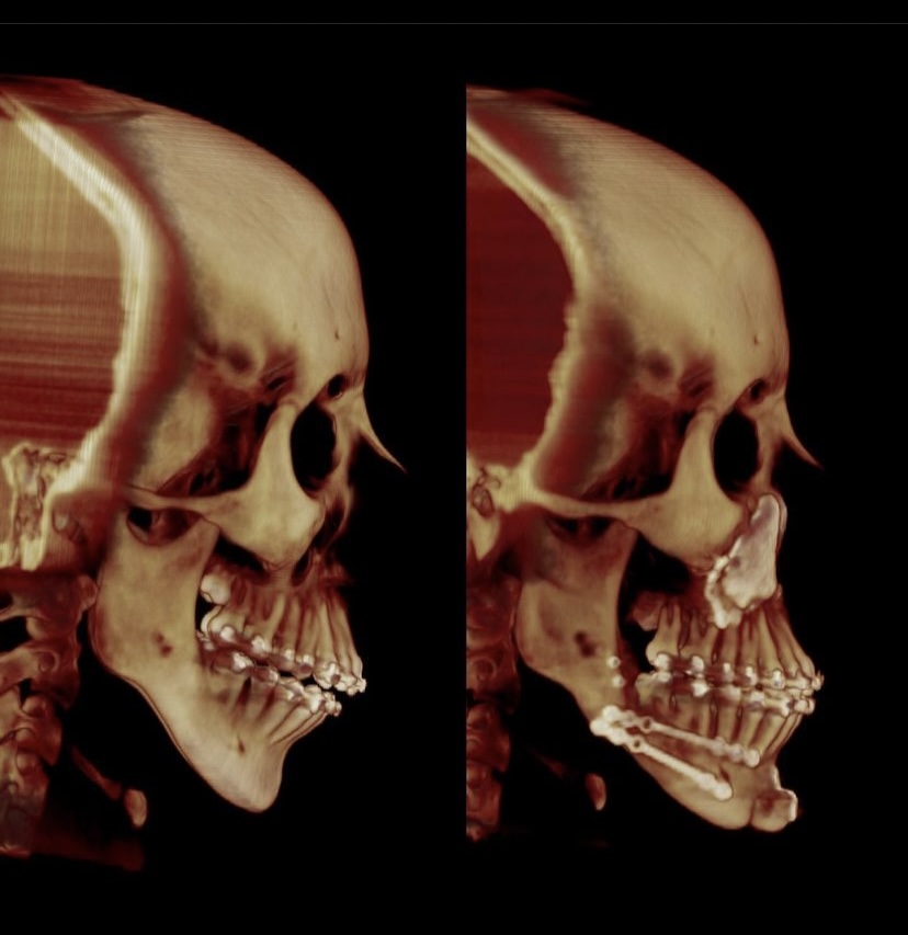 2A2F15AE E139 4044 AEE7 A555AF7BCD7D