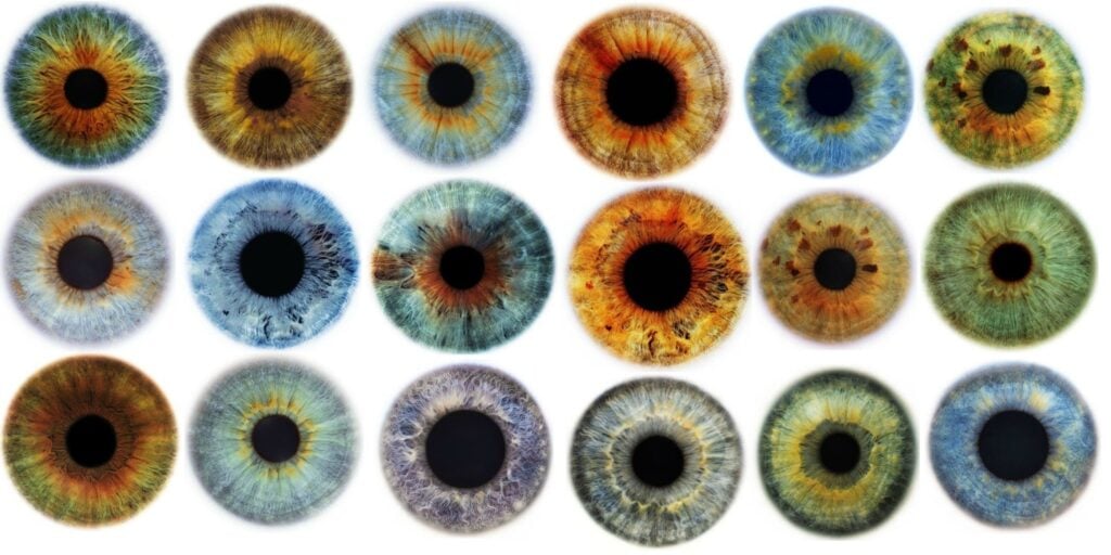 Central Heterochromia 1024x512