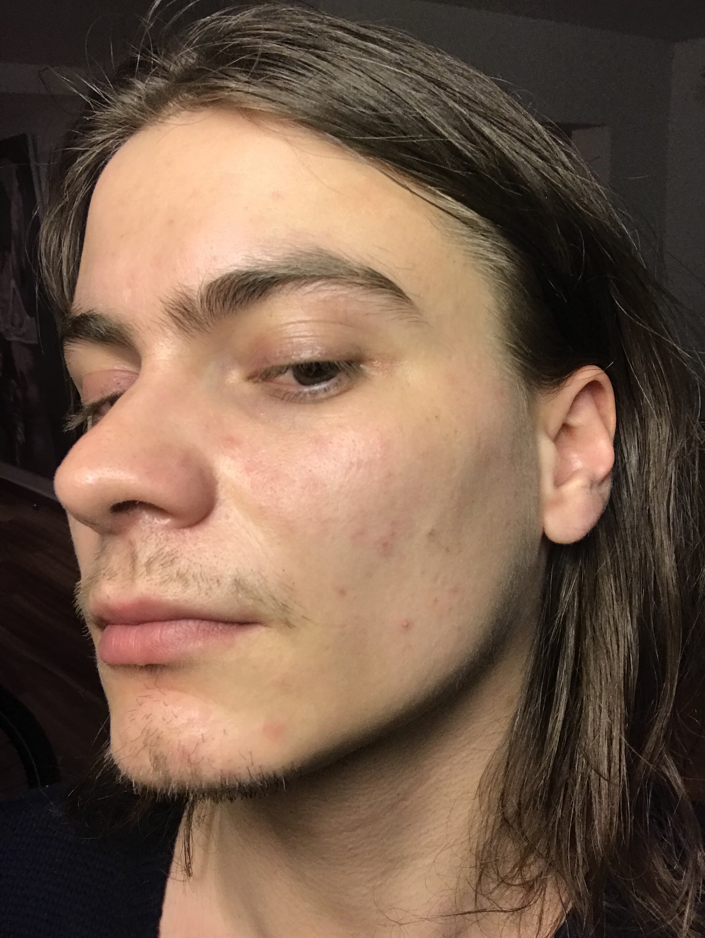 IMG 2862