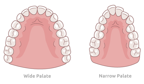 Palates