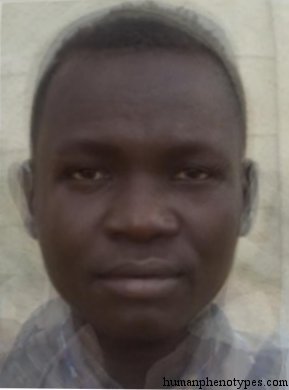 Prenilotidm