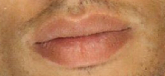 C805899A 5F06 47D1 AF79 36AD59B4DF7D