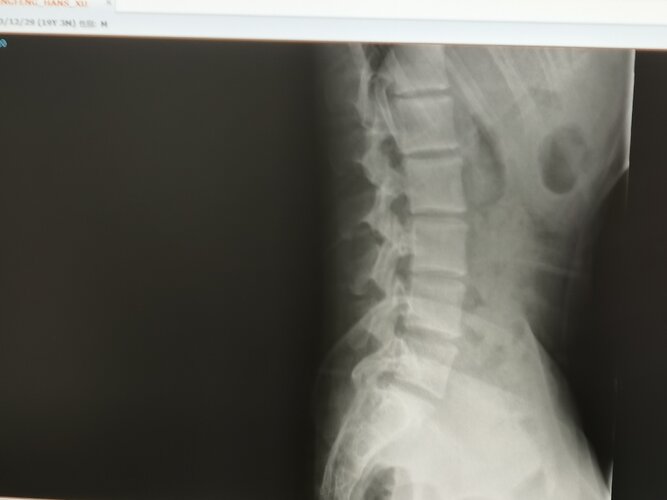 Spine 2