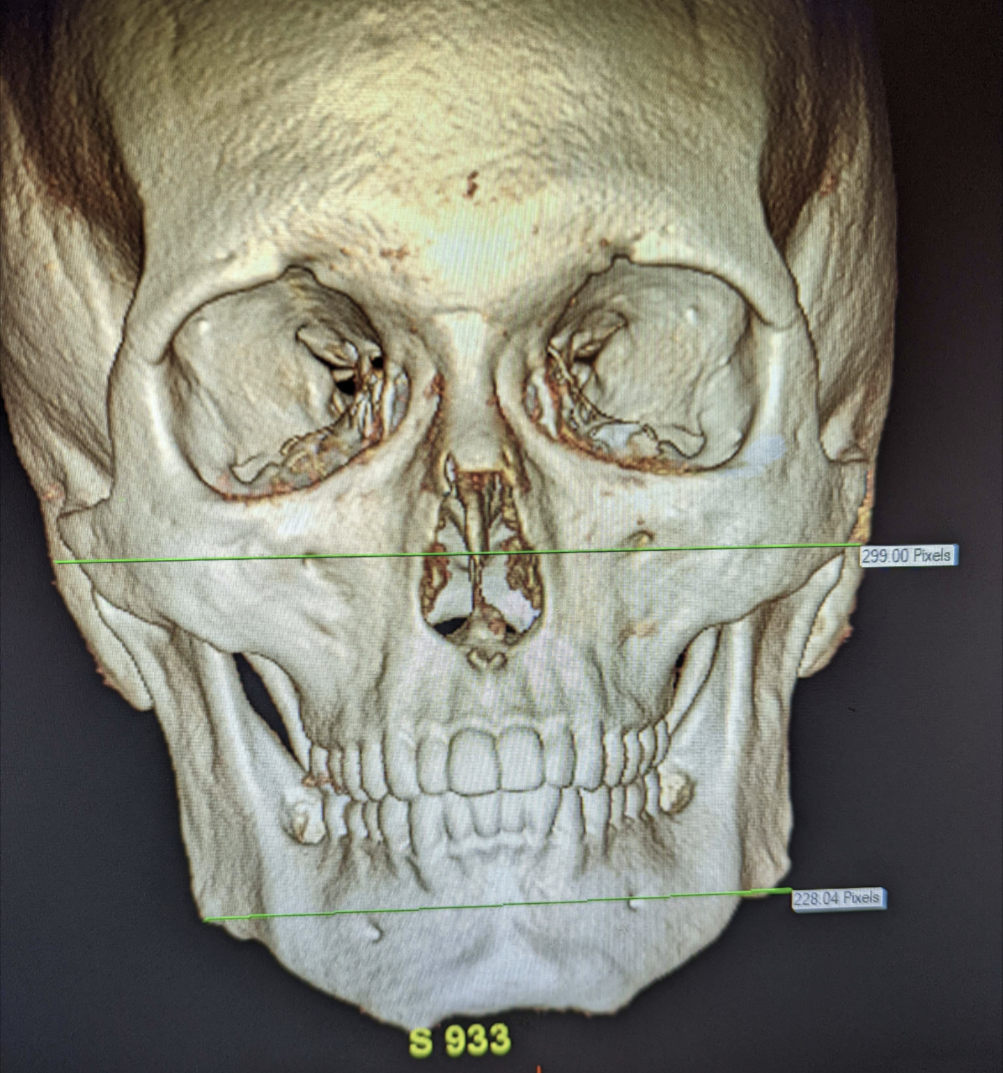 Screenshot 20230508 1700432