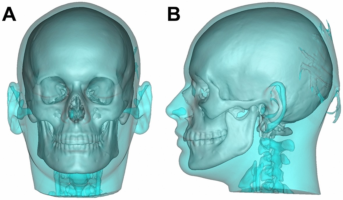34C64119 2EA8 4D53 9A75 73E666AD7A2C