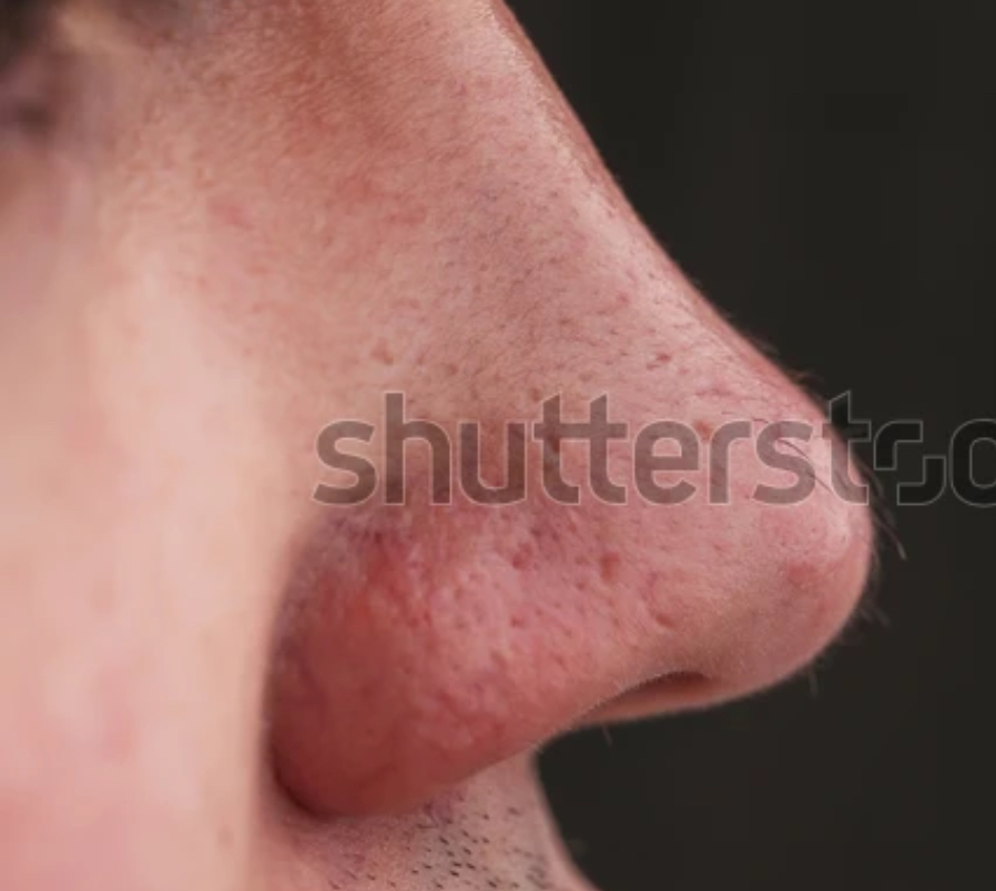 1300F86D 633A 4ABA B6BD 2CD7539EE06E