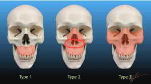 8528D872 76C2 408E 8614 485BA99FA0C4