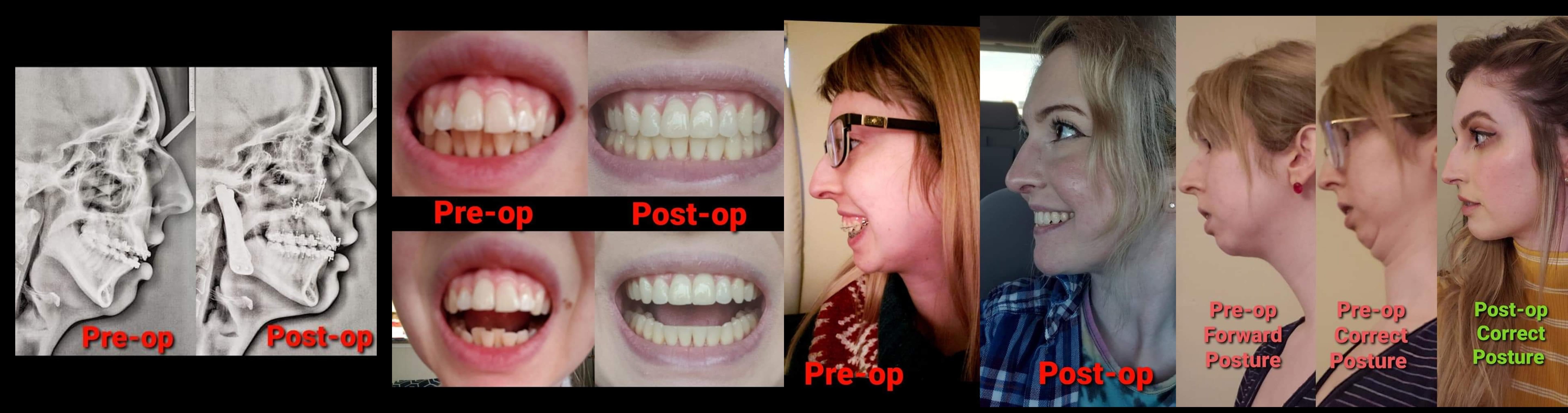 Imgonline com ua twotoone ojDPNGLrNkG