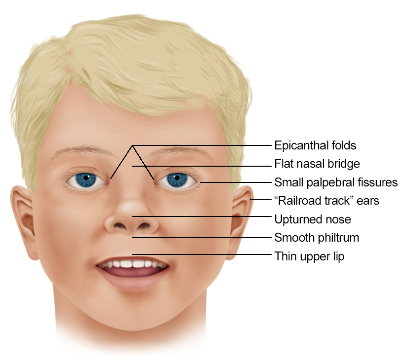 Facial details