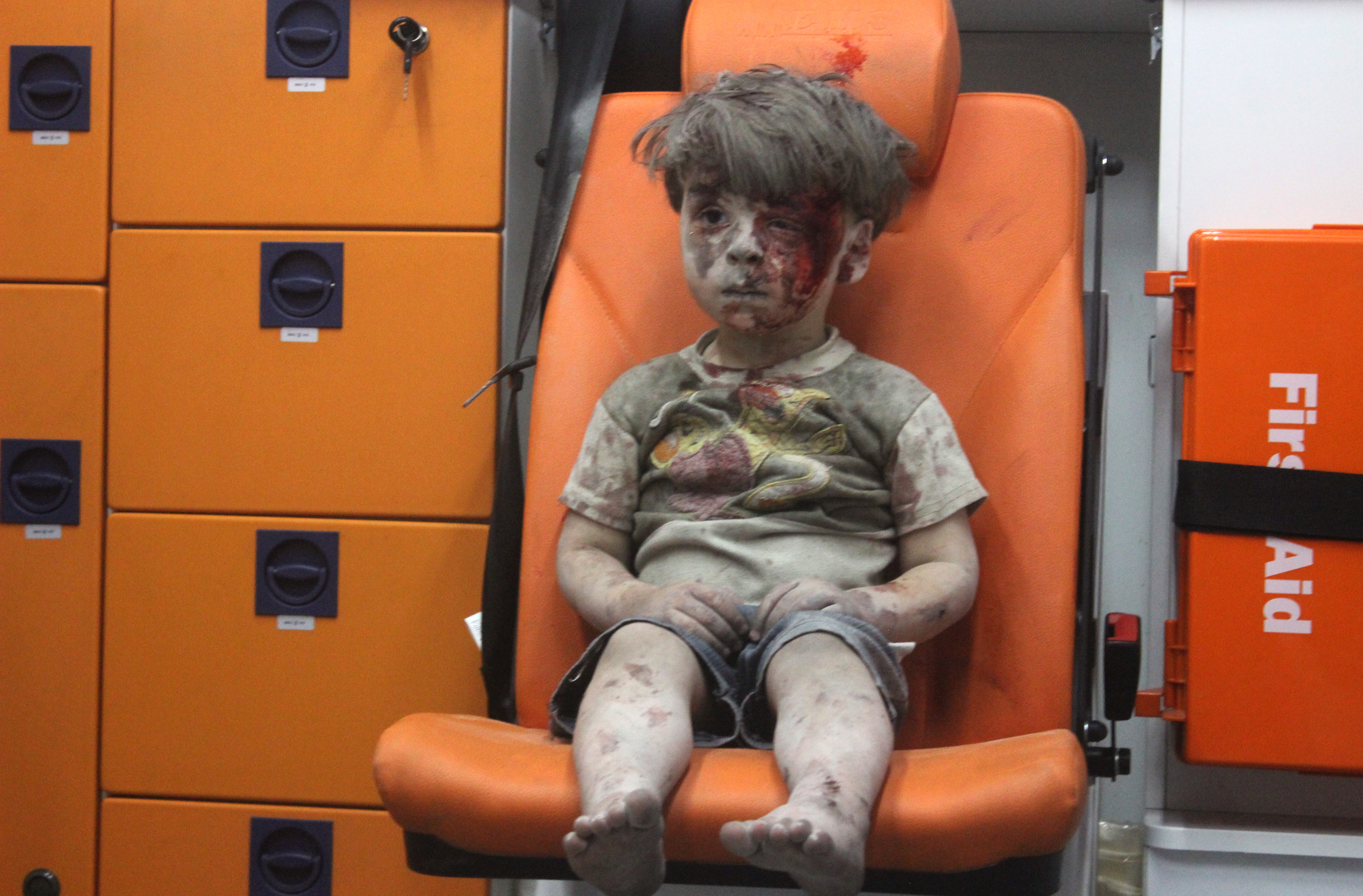 Omran daqneesh ali dead