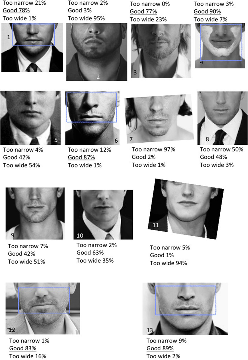Answers to question 3 regarding the aesthetics of bigonial width compared to bizygomatic 2