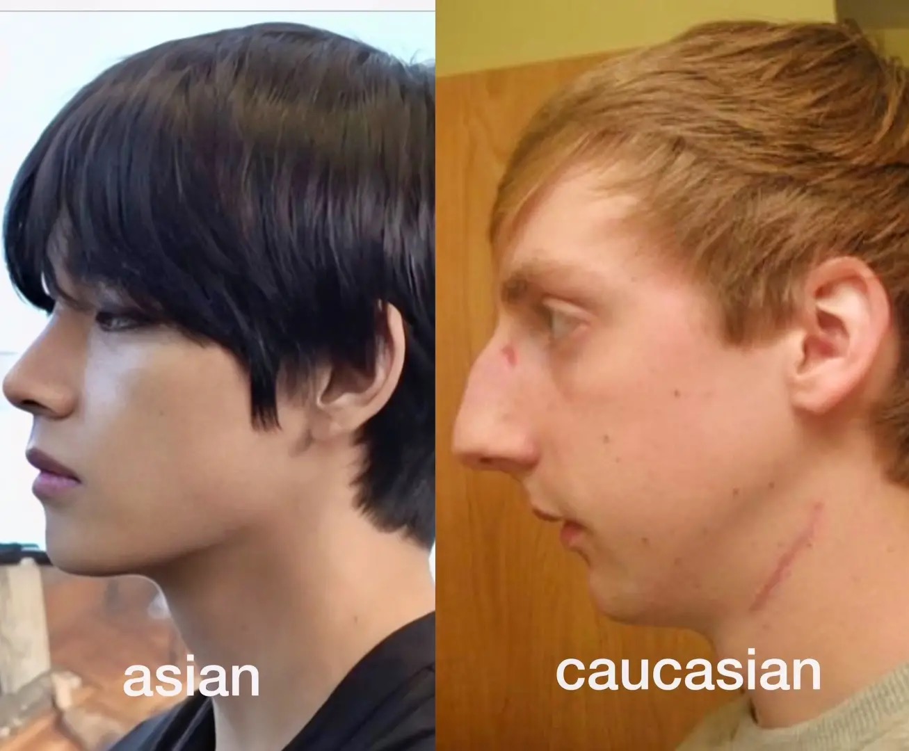Insane ricecel coping detected on tiktok | Looksmax.org - Men's Self ...