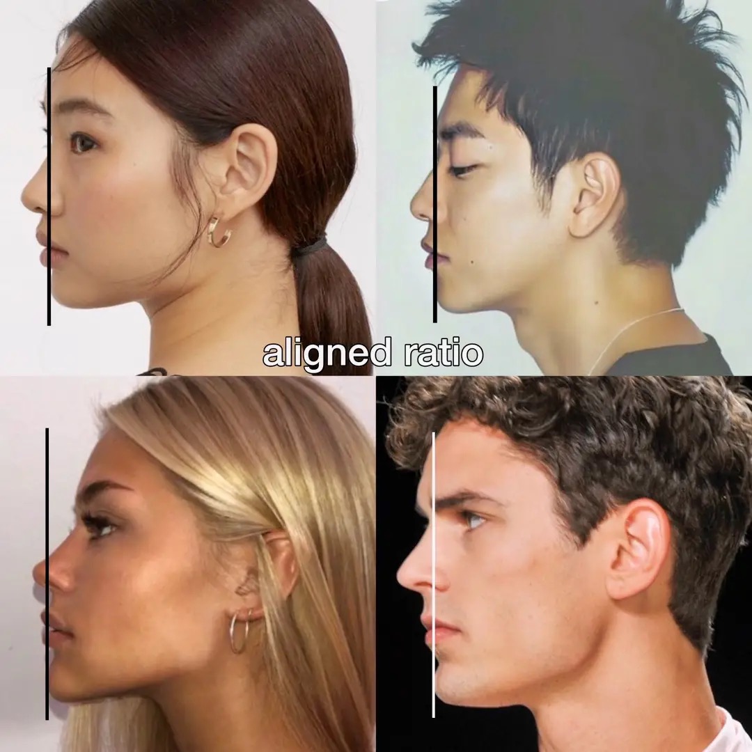Insane ricecel coping detected on tiktok | Looksmax.org - Men's Self ...