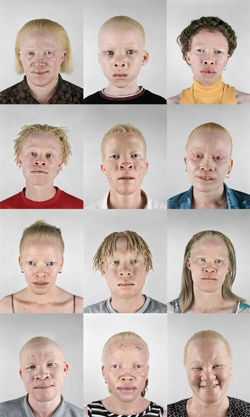 Black albino