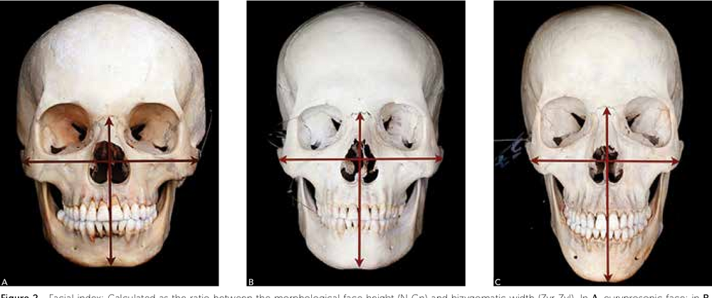 facialindex.png