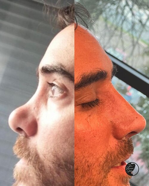 Sercangode docdr 23 05 2023 0004