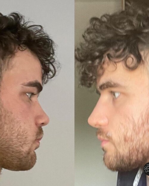 Sercangode docdr 23 05 2023 0003