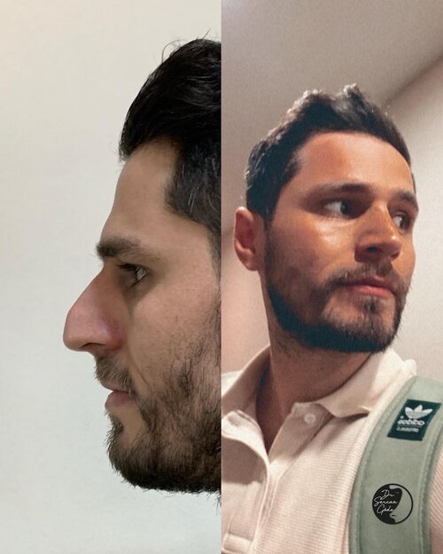 Sercangode docdr 23 05 2023 0002