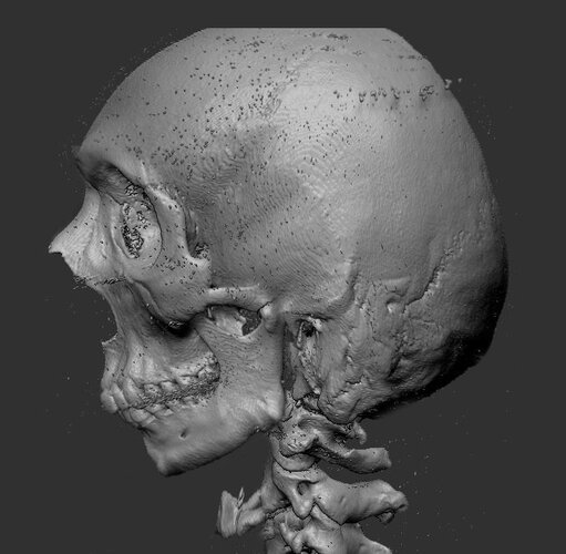 CBCT