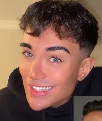 Wtf2