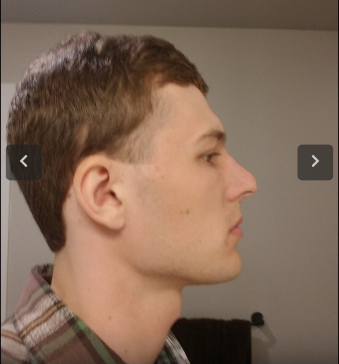 Screenshot 20230604 040216 Plastic Surgery Simulator