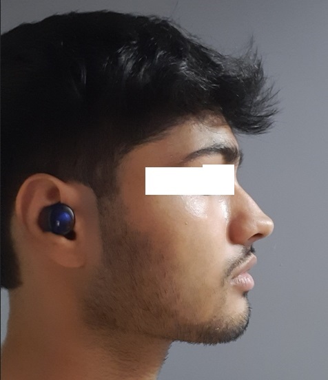 Sideprofile