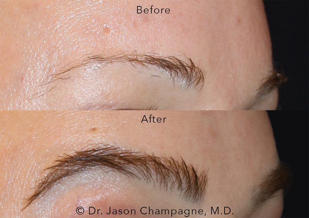 Beforeandafter3