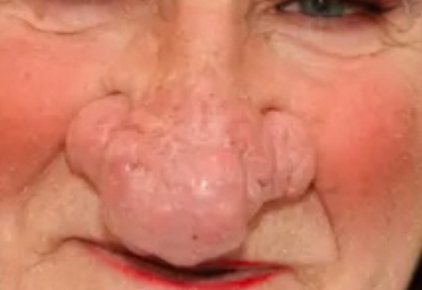 Screenshot 20230607 183236 Samsung Internet