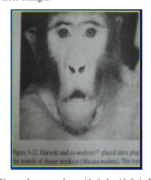 3325850 EDF643F6 4026 4738 9D21 3F3F4F8AA6E3