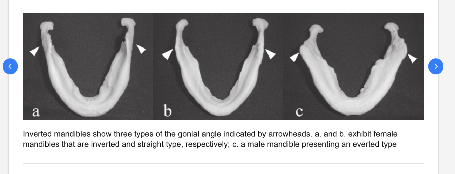 9AFB9423 FFF5 4D46 8F3D 6F859042F4C6
