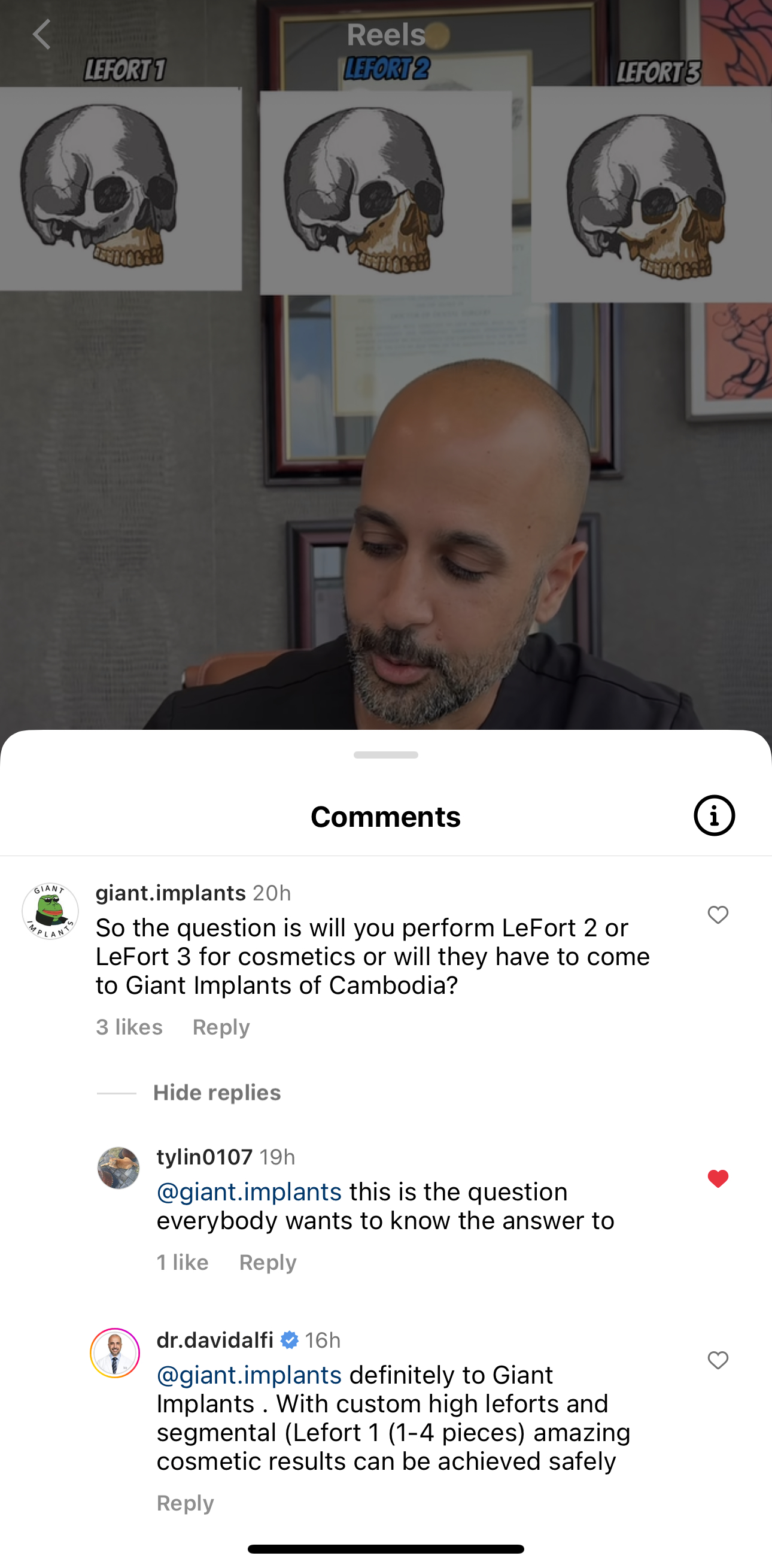 53198038 20C1 4FF3 B083 750E5F24BCBB