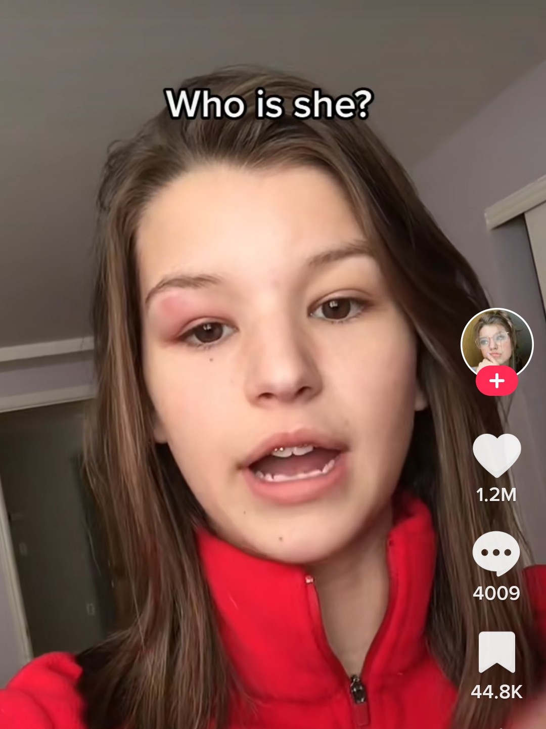 3466031 stacy