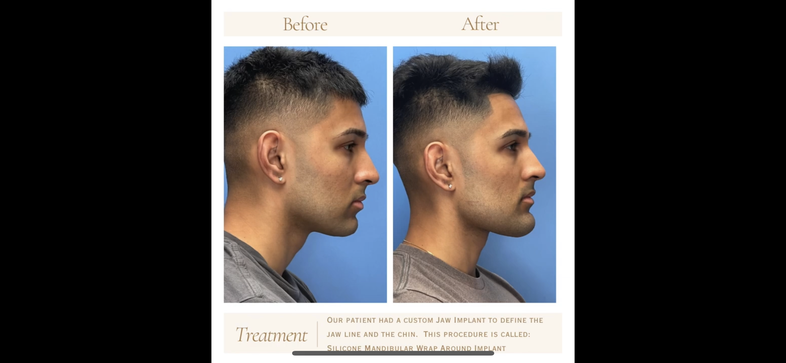 0FE4942E 38BC 438F 838A EB97EFF326AB