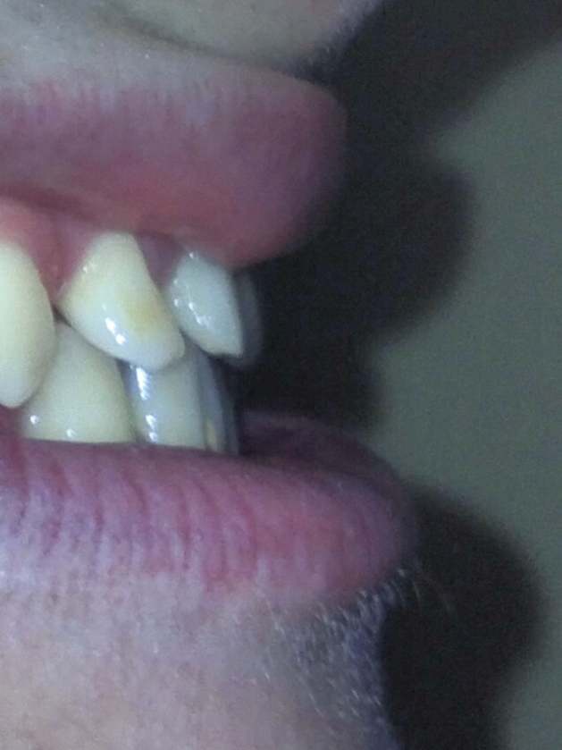 IMG 20230614 182604