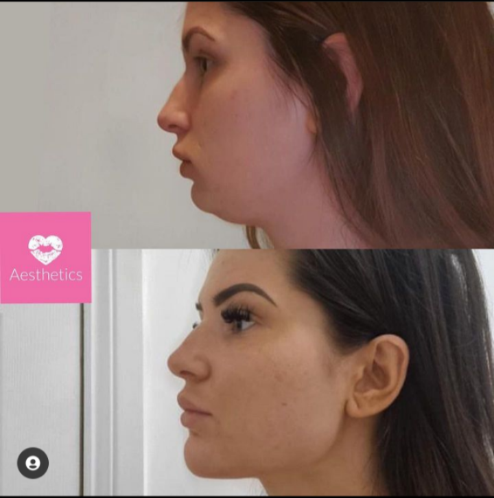 Screenshot 20230616 133646