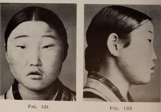 Asian