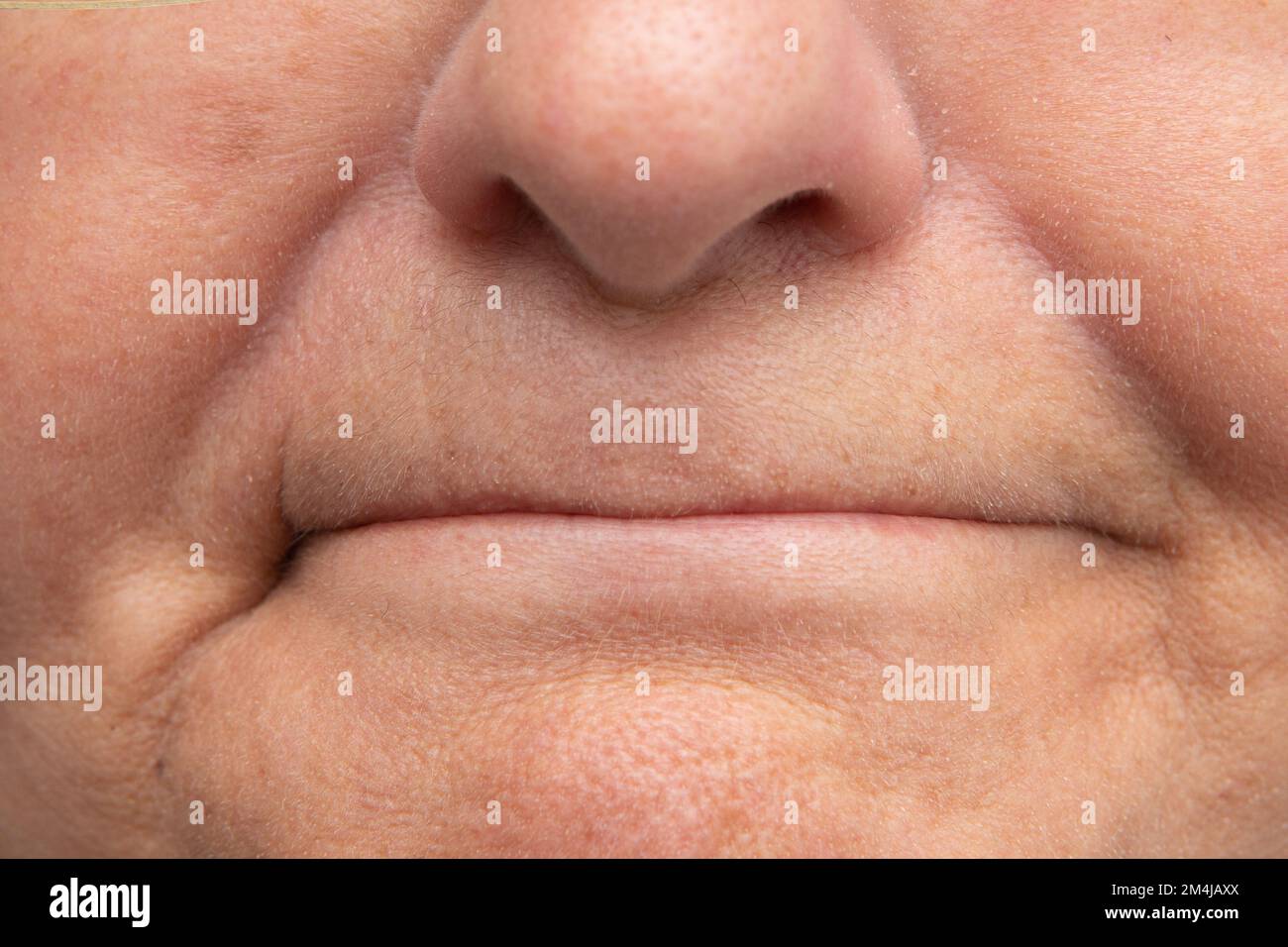 Woman mouth with thin lips need for fillers to fill and give volume to the lips 2M4JAXX