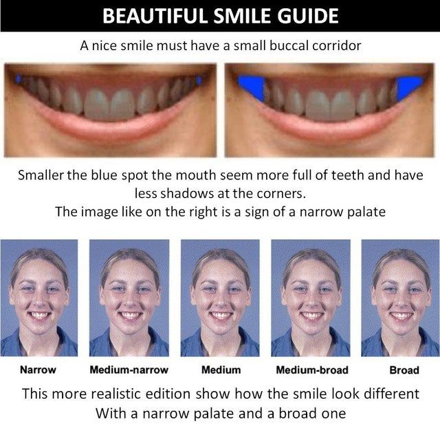 17242856b3e21369dba577240b662e48