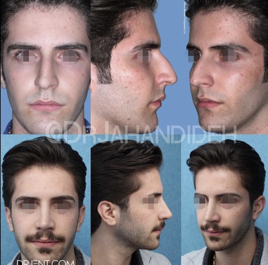 BE7344D6 C634 48B8 85F4 D05358973CD5